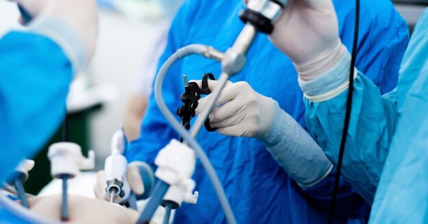 Minimally Invasive Fistula Surgery Minimally Invasive Fistula Surgery