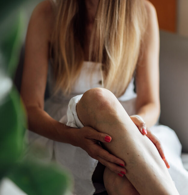 Woman,At,Home,Massaging,Tired,Painful,And,Spider,Varicose,Veins. varicose-vein-doctor-riverside