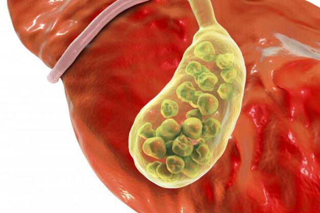 gall-bladder-disease gall-bladder-disease