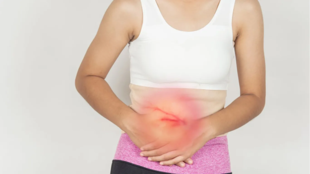 Post-Cholecystectomy Syndrome Management Post-Cholecystectomy Syndrome Management