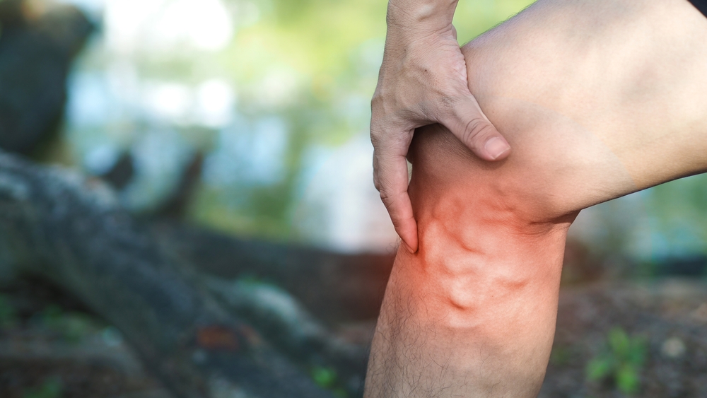 prevent varicose veins Riverside prevent varicose veins Riverside