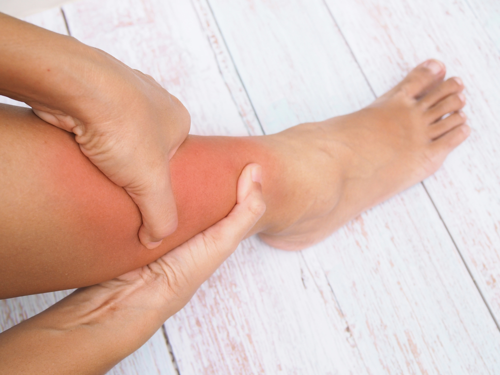 leg swelling vascular specialist Riverside leg swelling vascular specialist Riverside