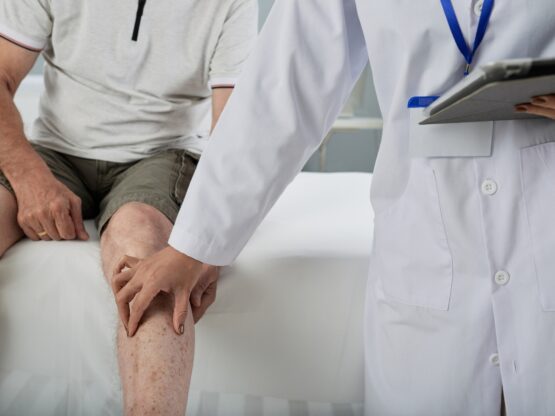 Leg Pain from Poor Circulation: Causes, Treatments, and When to See a Specialist