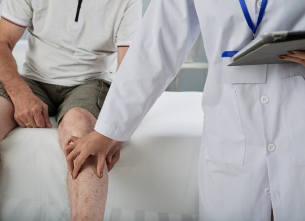 Leg Pain from Poor Circulation: Causes, Treatments, and When to See a Specialist