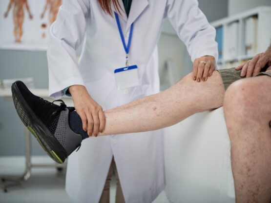 Varicose Vein Treatment Near Me: Options, Costs, and What to Expect
