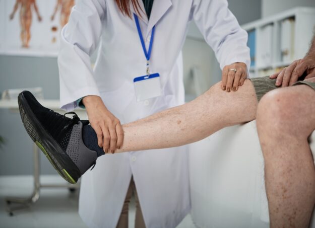 Varicose Vein Treatment Near Me: Options, Costs, and What to Expect