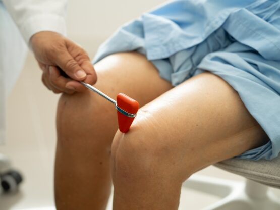 6 How to Find the Best Vein Specialist in Riverside, CA