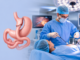 Gastric Bypass Surgery Near Me: Benefits, Risks, and Recovery